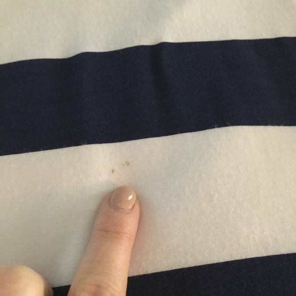 Lilly Pulitzer Devon Stripe dress - Picture 7 of 8